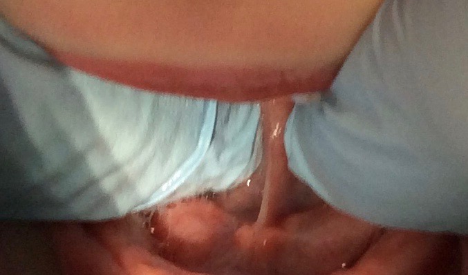 Fingers lifting up tongue to visualize a lingual frenum (tissue attaching tongue to the floor of the mouth)